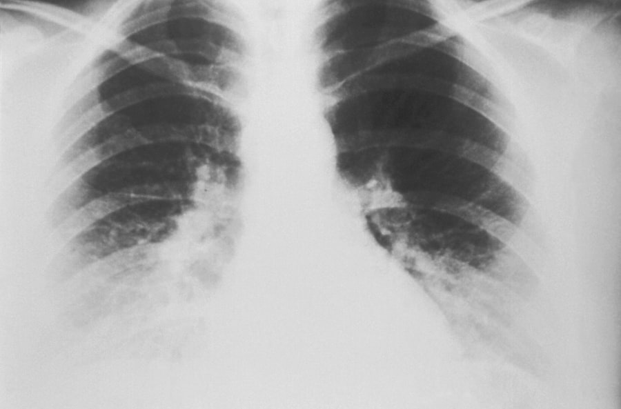stabilitate pe termen lung